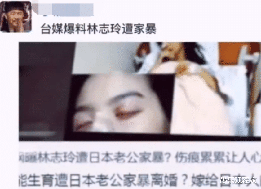 |大瓜！曝林志玲遭日籍丈夫家暴，假体被打出，男方曾多次出轨