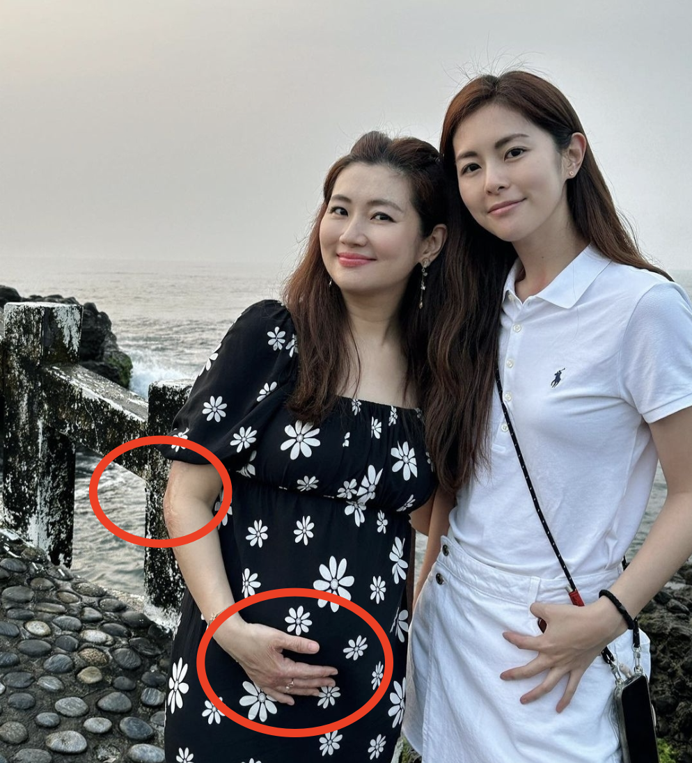 selina晒全家出游照,手捧孕肚出镜,手臂烧伤疤痕曝光 - 育儿资讯(主打