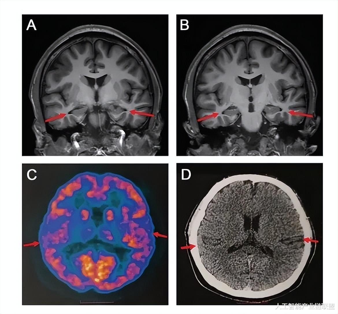 界面设计|高通宣布继续向华为供货，中国石化投资设立智能机器人公司