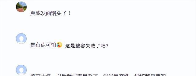 秦海璐|47岁秦海璐陷整容风波,脸肿成发面馒头,额头高的被嘲像寿星老