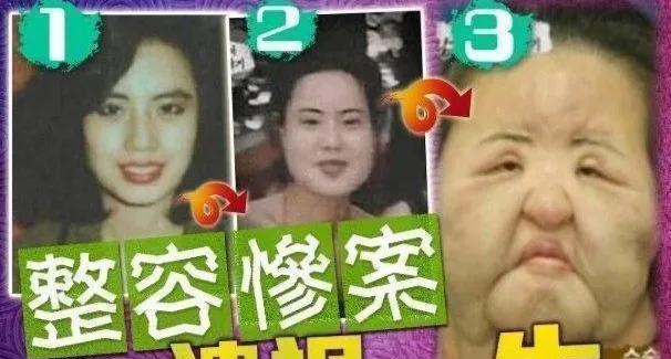 韩慧景|28岁女歌星整容成瘾!缺钱整容自己动手