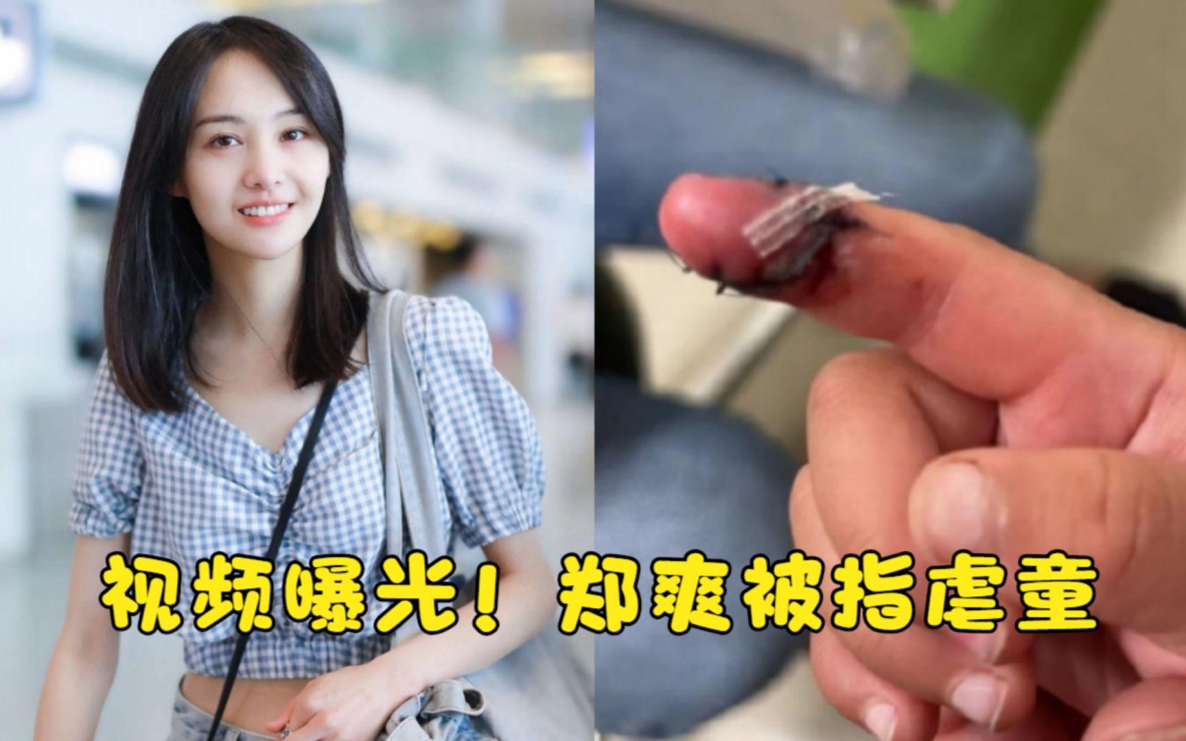 郑爽|郑爽给孩子庆生照曝光,怀抱孩子相处融洽,年前被指虐待儿童!