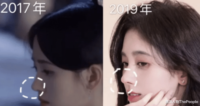 牛莉|49岁王艳陷整容风波！苹果肌突出、超宽双眼皮太抢镜，牛莉更离谱