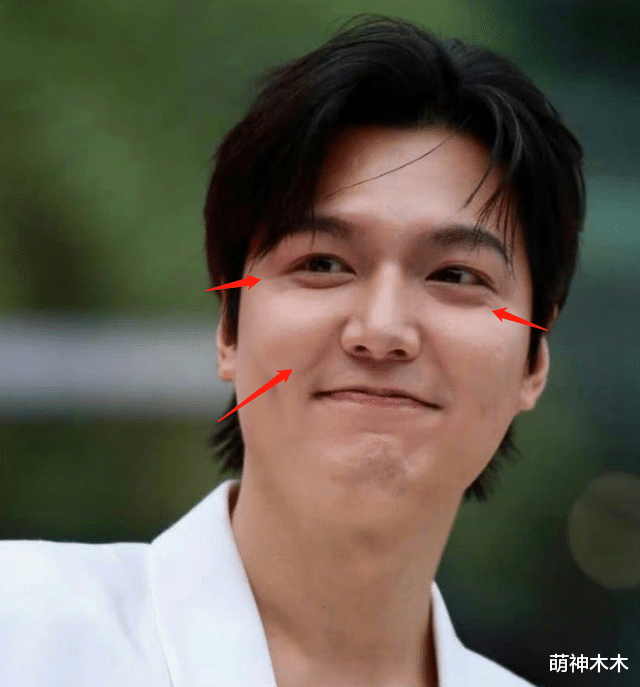 李敏镐最新生图不敢认!脸颊胖到像气球,疑似整容后遗症爆发