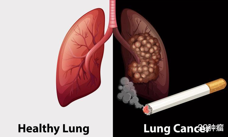 |为什么有的老烟民吸烟不得肺癌，还很长寿？美国研究给出了答案