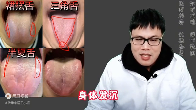 肝不好,命不长!4种舌象案例,中医教你养肝正确方式!