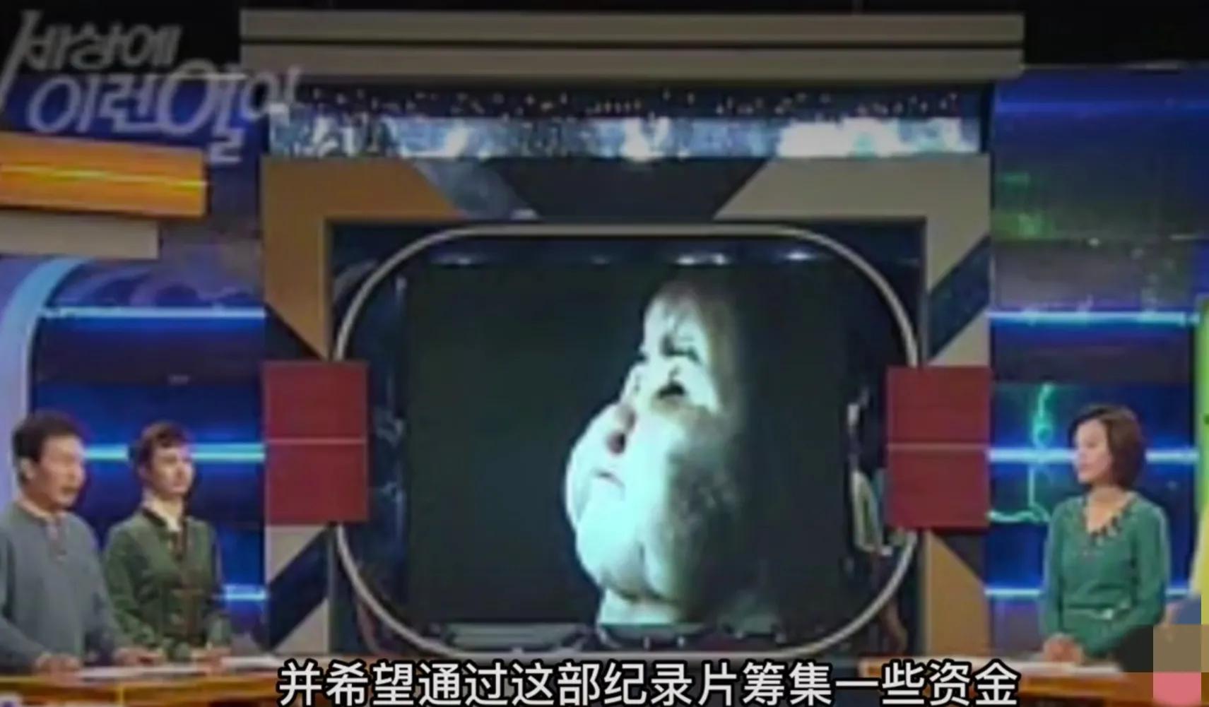 韩慧景|28岁女歌星整容成瘾!缺钱整容自己动手:脸上注射香油和水泥!