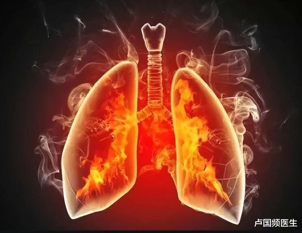 肺火、心火、胃火、肝火、肾火，别管什么火，总之你上火了！