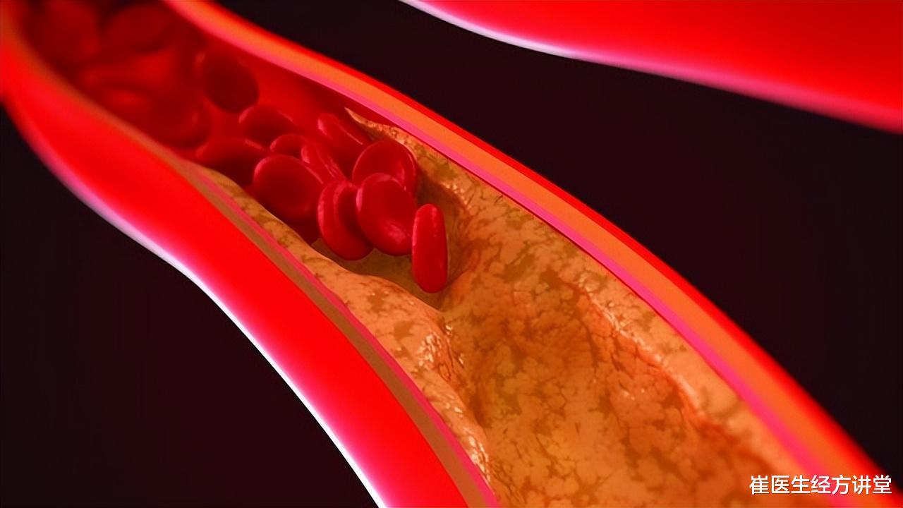 一个名方，扫清体内陈年的寒气、痰湿、瘀血，这个冬天告别冷痛僵