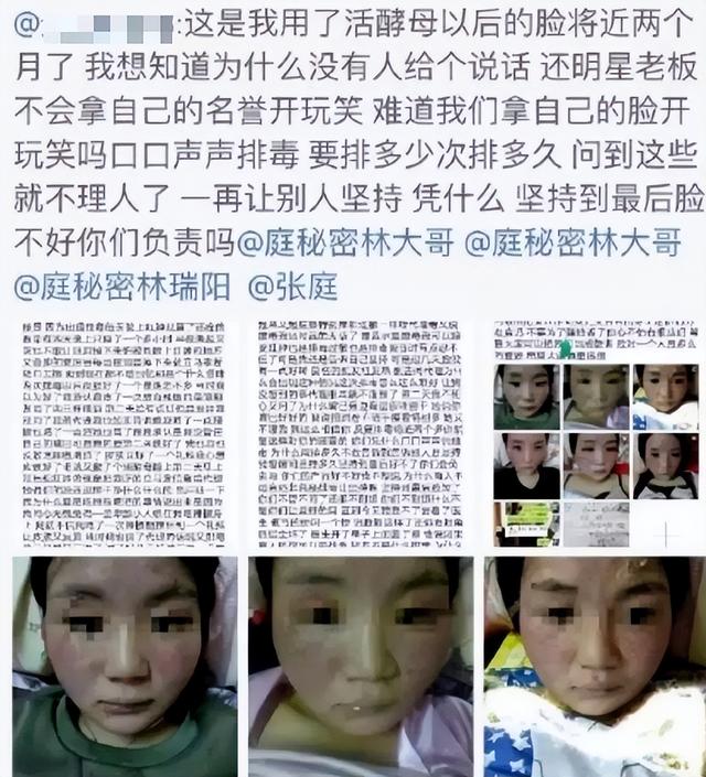 “毫无底线”的张庭夫妇,终于为自己的“贪得无厌”付出了代价