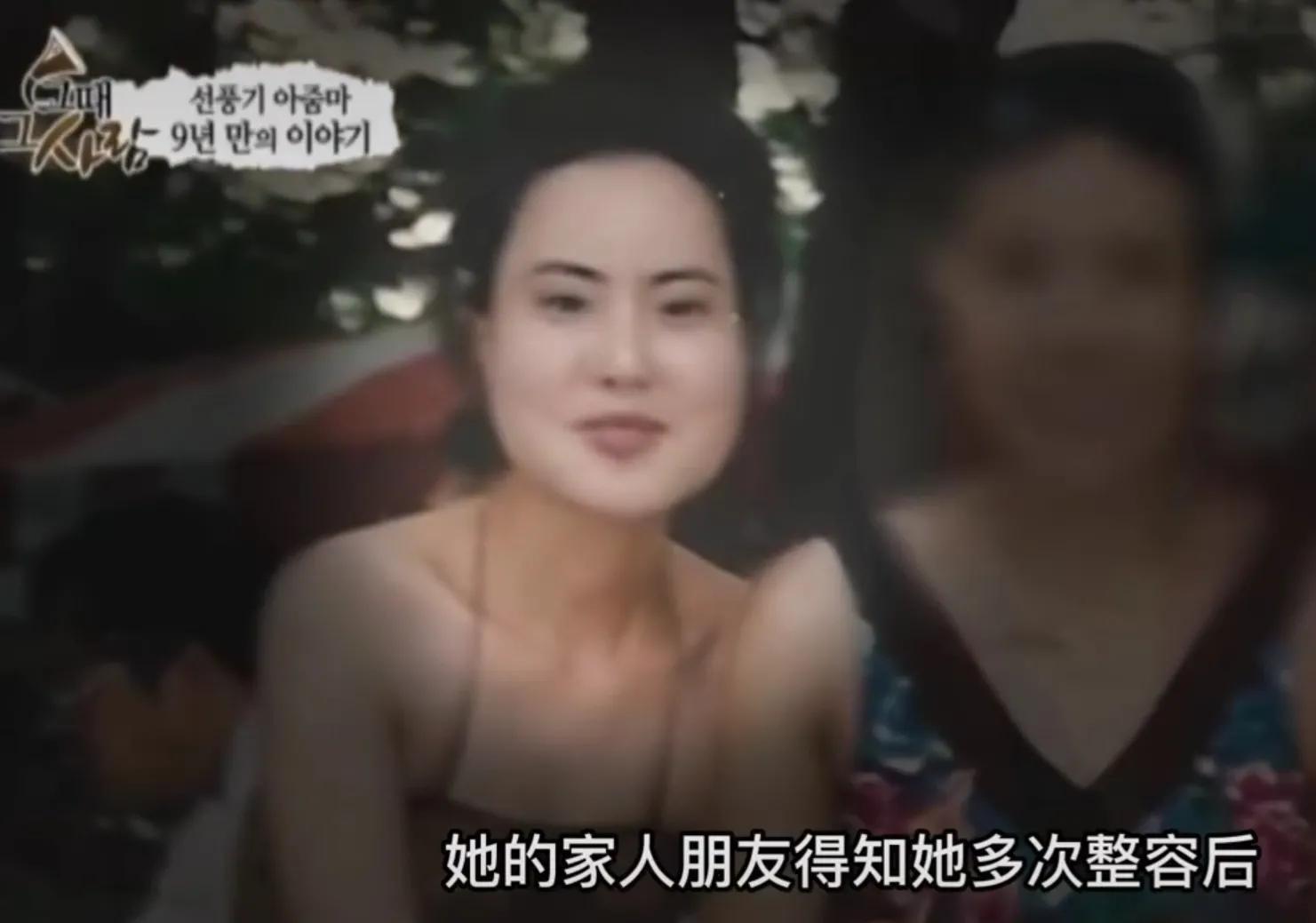 韩慧景|28岁女歌星整容成瘾!缺钱整容自己动手:脸上注射香油和水泥!