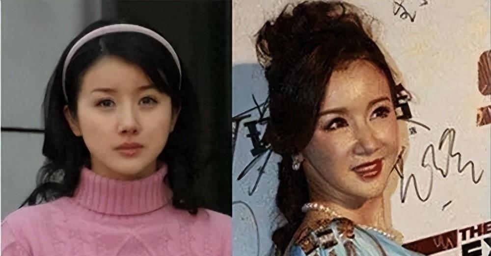 长得“歪瓜裂枣”,整得“美若天仙”,这5位女星全都靠脸逆天改命