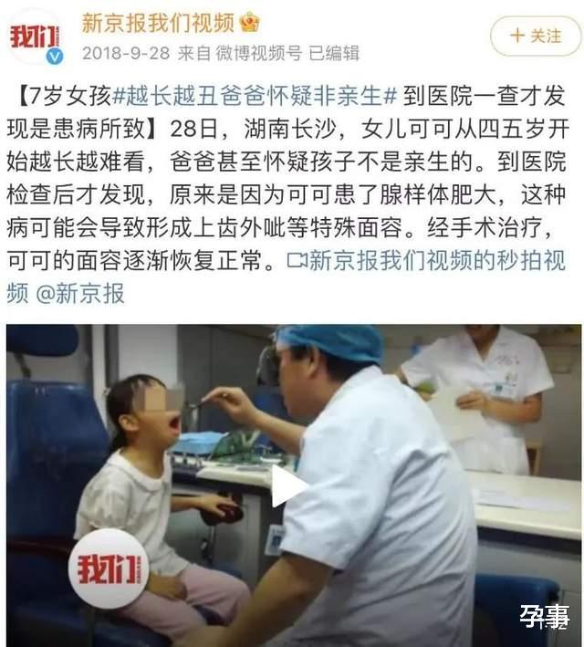 杜宇麒|嗯哼被怀疑是腺样体面容 ，霍思燕回应：医生说不是