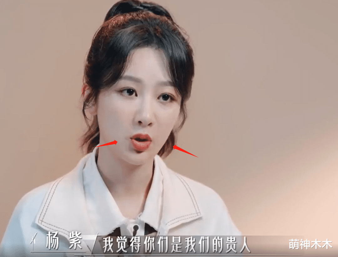 杨紫综艺上线暴露状态，法令纹夸张下巴变尖，网友吐槽医美后遗症