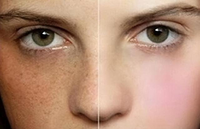 山楂|香蕉是高血脂的“催化剂”吗？心血管主任：春季，2种水果请少碰