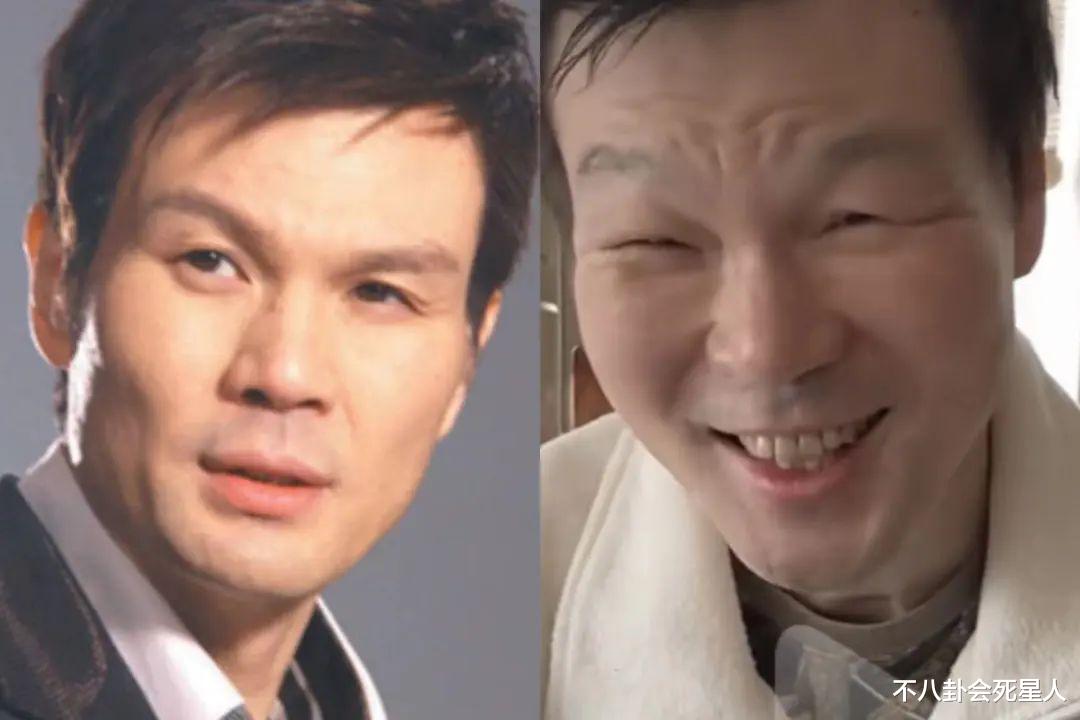 孟非|消失男主持近况:孟非变帅,周立波头发快掉光,李彬病到眼睛睁不开