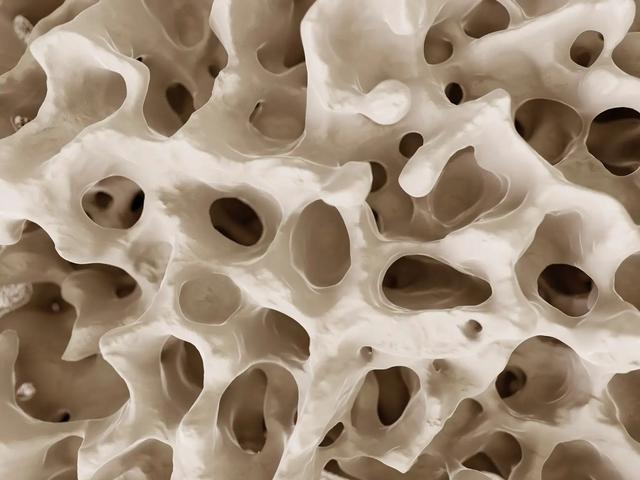 bmi|常见减肥手术的隐患：青少年和年轻人因此发生骨骼脆弱