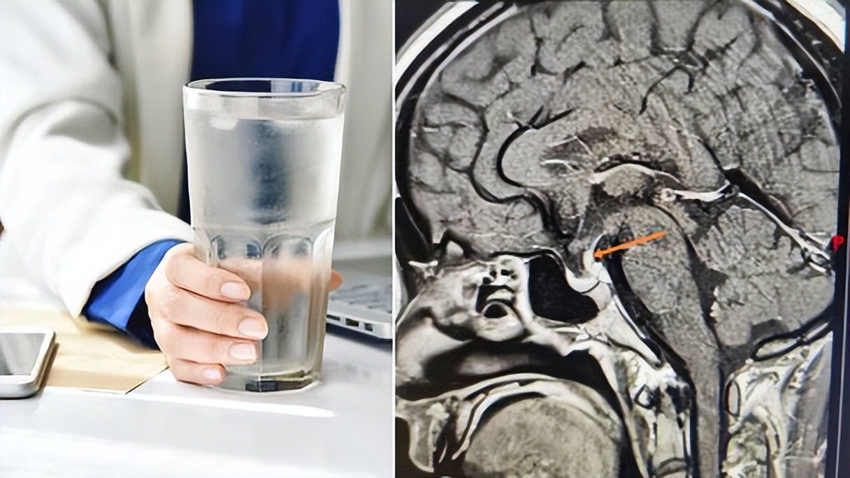 男子每天喝30斤水去50次厕所