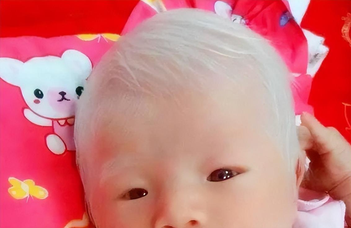 孩子长了白头发，别慌！可能是你没给吃对