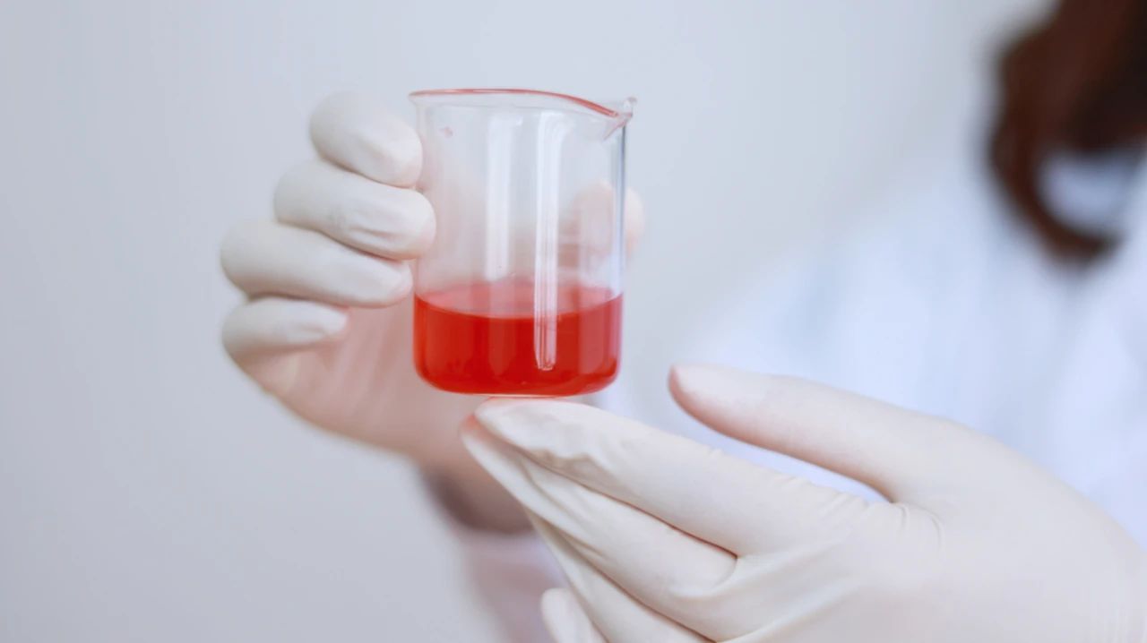 高尿酸患者注意：若身体有这3种“表现”，可能是肾衰竭找来了