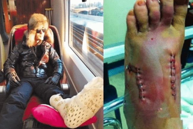 成龙骨头全脆,李连杰残疾证,吴京100多针 - 娱乐资讯(主打网)