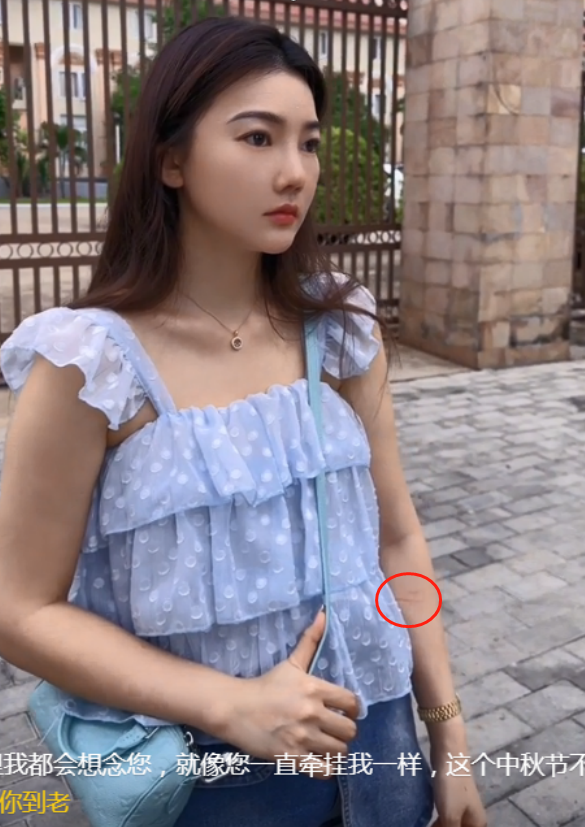 曝柬埔寨甜甜圈疑怀孕,小腹微凸浮肿惊现绑痕,疑为保命怀龙少娃