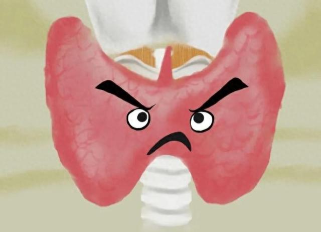 鸡蛋是甲状腺结节的“发物”？医生：保护甲状腺，4物需要管住嘴