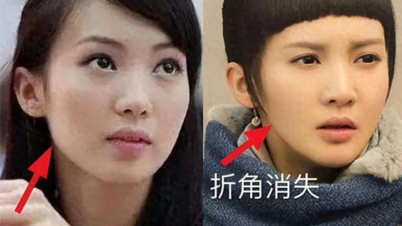 有种顽强叫“我没整容”！明明从大饼脸变成V脸，真当观众看不见
