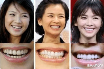 刘涛|44岁刘涛颜值回春,为何口碑却崩了?