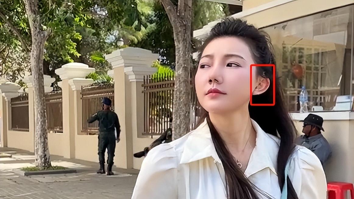 曝甜甜圈耳朵被割按假耳，多人监视疑被四轮定位，小肚隆起似怀孕