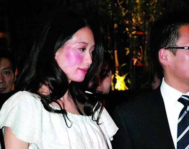 成龙|口水能过敏,天生没子宫,这10位明星的“隐疾”,困扰他们许久