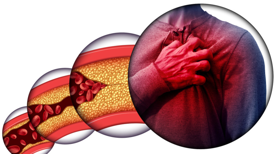 上年纪的人，担心血管堵？提醒：日常牢记“6要”，血管更年轻