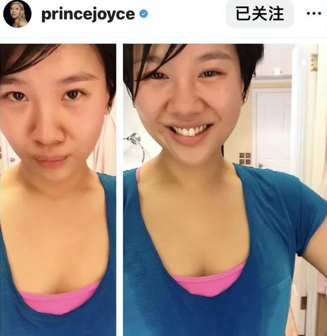 郑欣宜失踪5个月后露面，暴瘦90斤后太像郑少秋，如今官宣复出