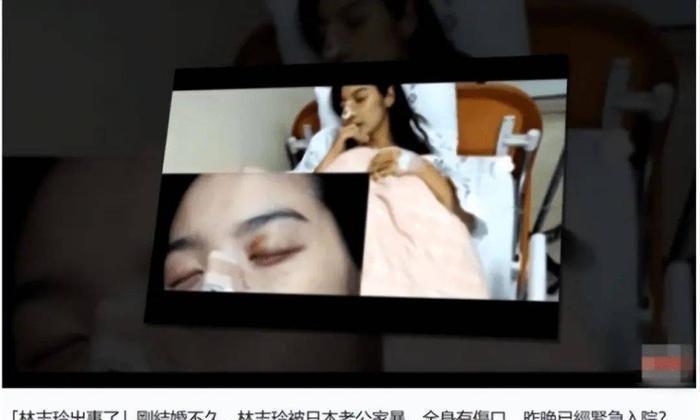 林志玲|下嫁日本人,47岁冒险产子的林志玲,终为无知买单