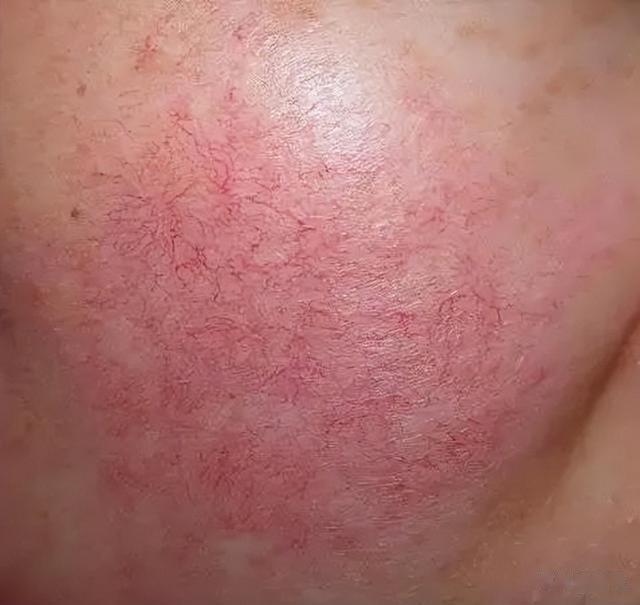 运动 减肥减不下来，真跟皮质醇有这么大关系吗？