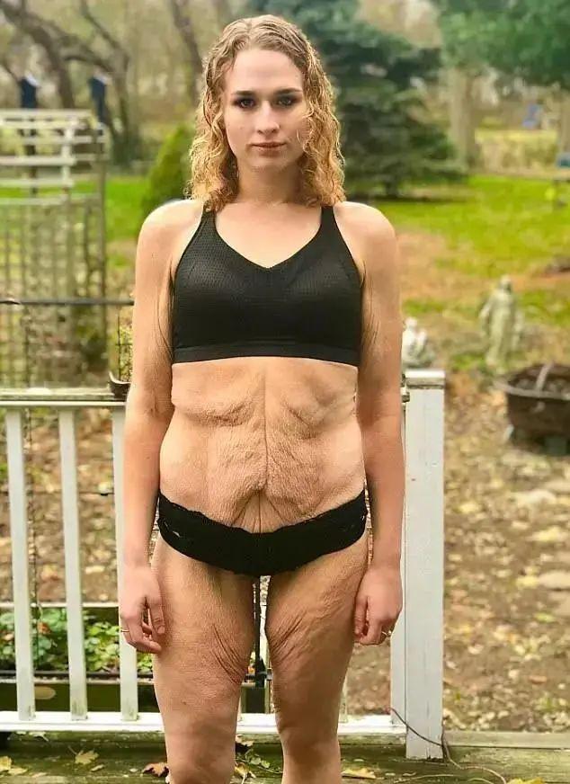 体重320斤的姑娘，减肥200斤后判若两人，从胖妞到美少女的转变