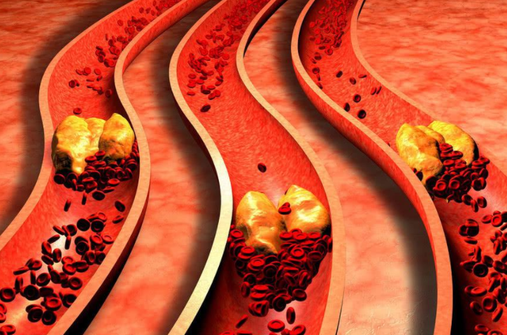 吃一口等于8斤洋葱，心血管主任：血脂高的人敞开吃，血管越来越软