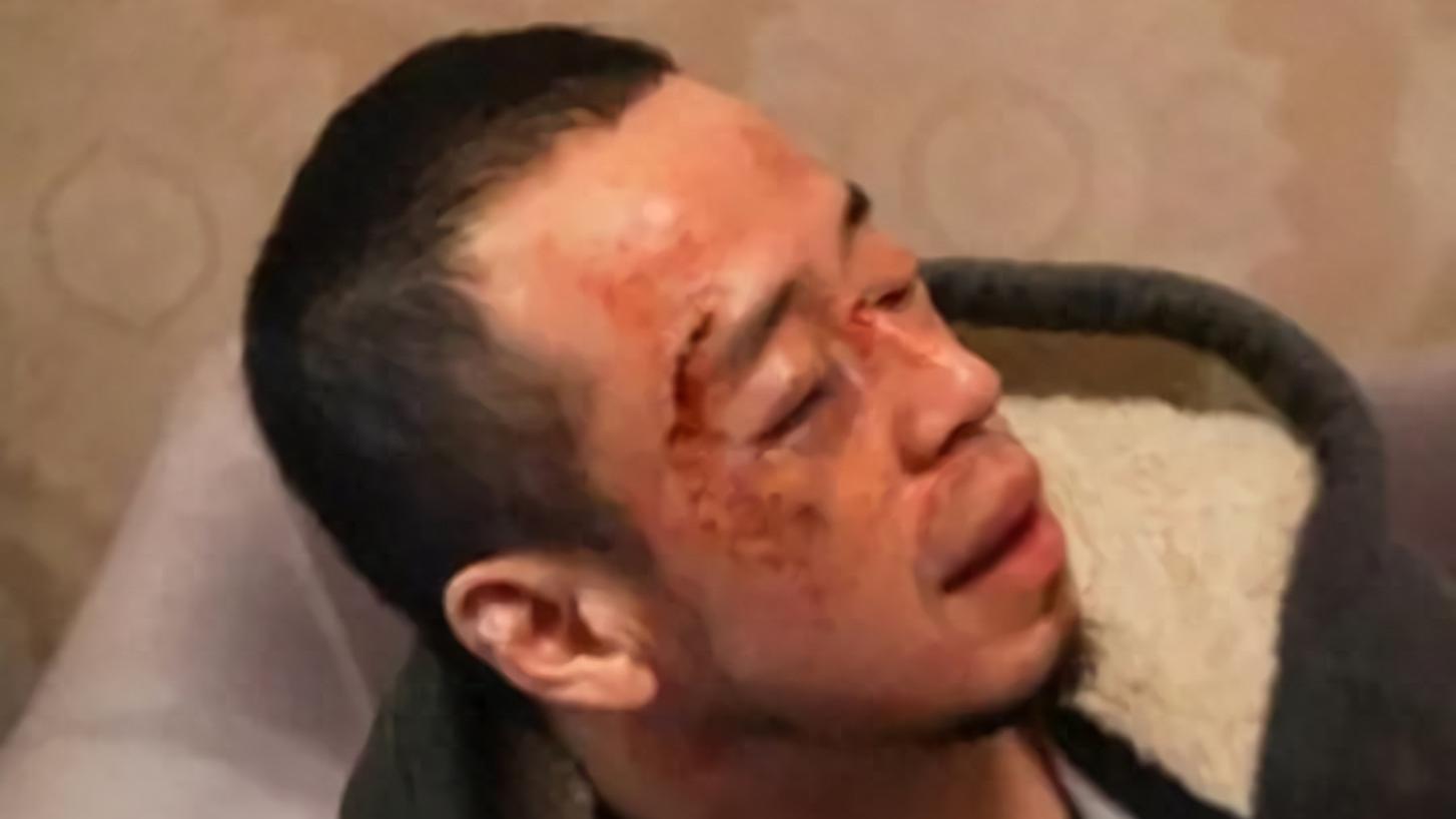 事不小！歌手杨坤在长沙演出后被群打，脸肿鼻青，现场画面流出