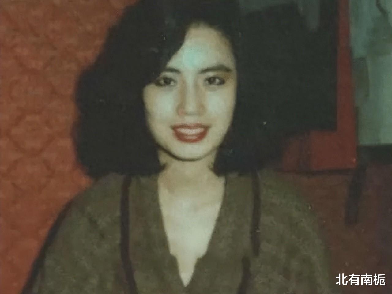 韩国女星整容上瘾注射大豆油,脸部取出8斤异物,最后孤独离世