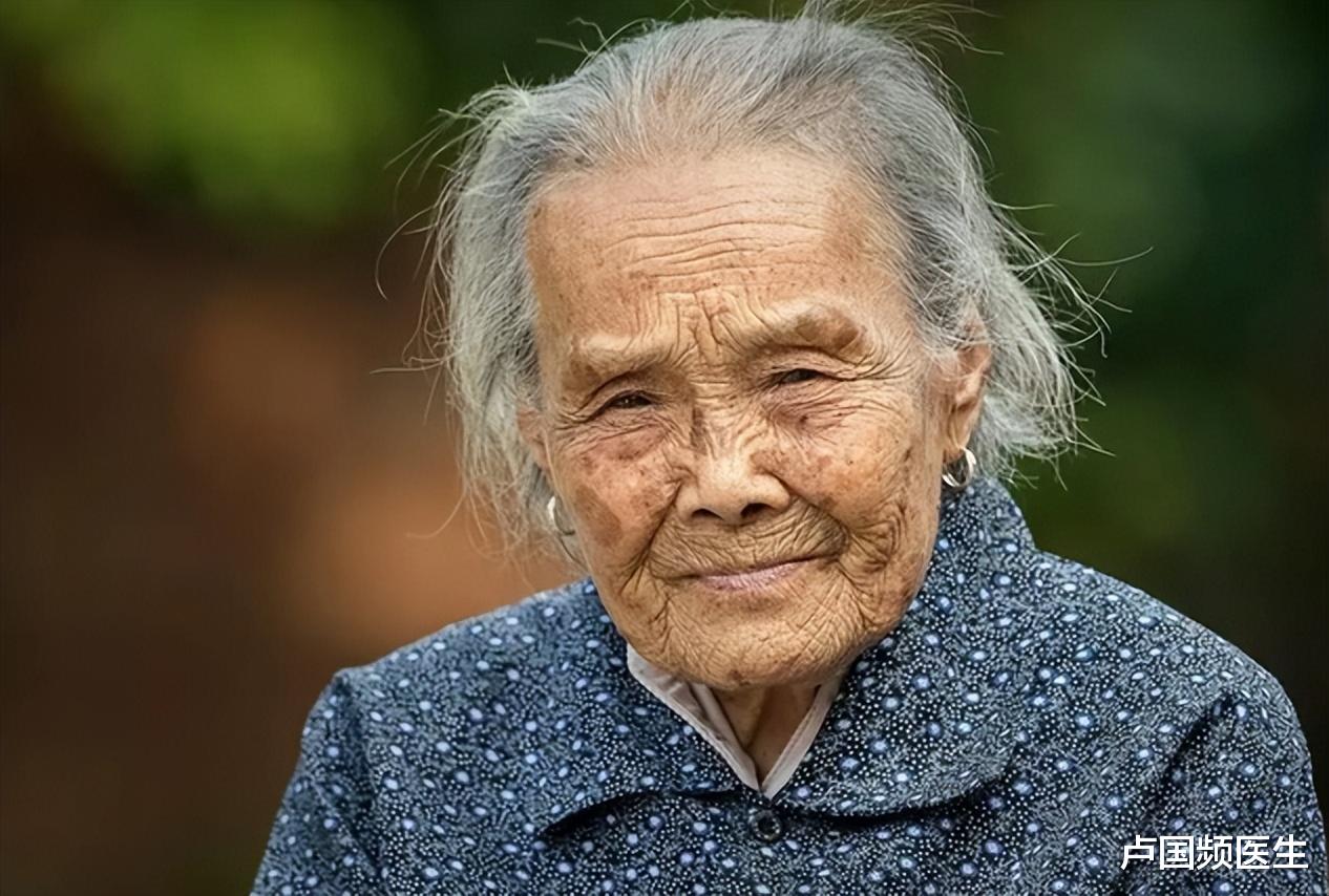 牙膏、生姜是老年斑的克星？医生坦言：能淡化老年斑的是2种方式