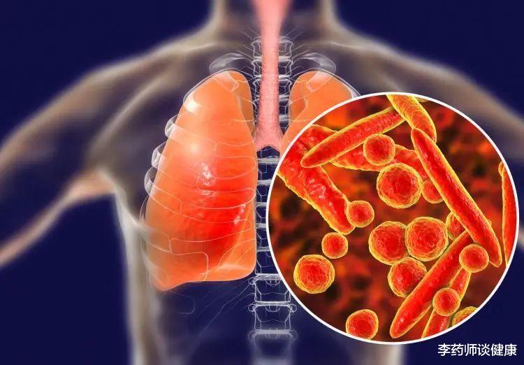 警惕！随着病例增加，“白肺综合症”正在席卷欧洲