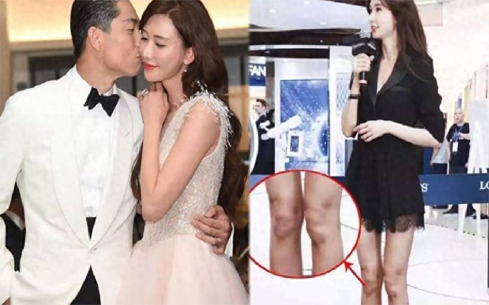 48岁林志玲坦言:婚后曾患上抑郁症,自杀未遂,并遭遇过家暴