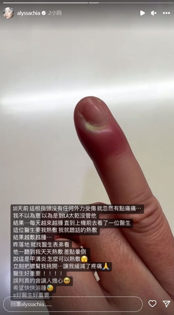 贾静雯|贾静雯美国陪女儿意外受伤！手指化脓红得发紫，被误诊忙返台求助