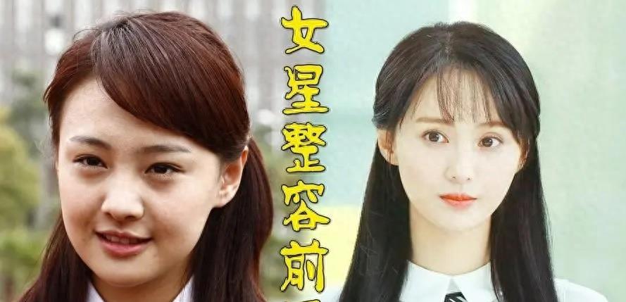 长得“歪瓜裂枣”,整得“美若天仙”,这5位女星全都靠脸逆天改命