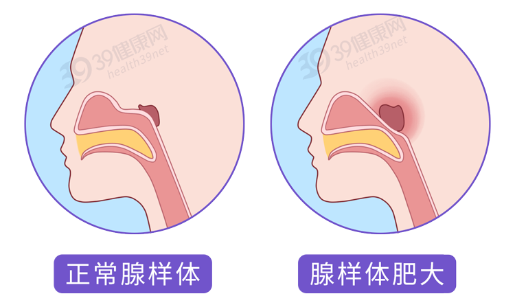 妇科|人体的这个器官可以“拿掉”，不会影响正常生活，是不是真的？