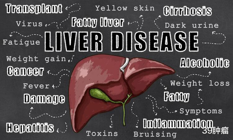 肝癌并非毫无征兆,上厕所时出现4个表现,说明肝已经“受伤”了