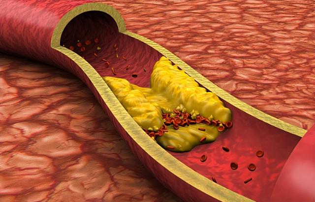 脾胃|为什么我们的血液会变得粘稠?3种水果多吃，或有助于疏通血管