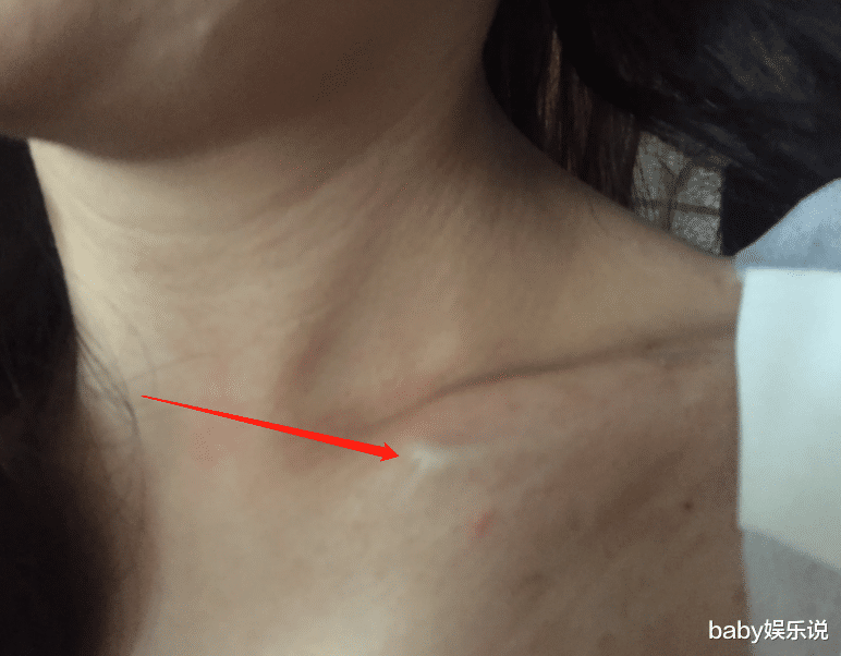 胡歌被实名指控,拍戏压断女主锁骨,只剩一点骨头连着,剧组封锁