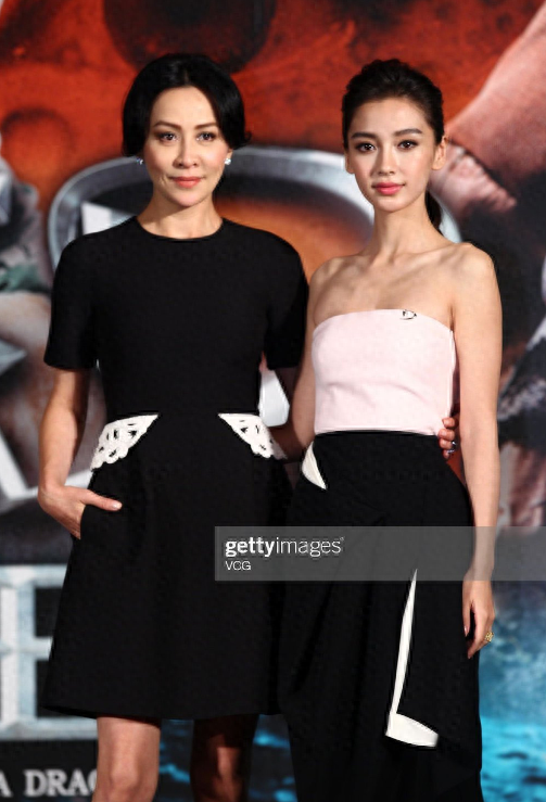 这么多年了，她的脸都没塌过，真不愧是“整容模板”