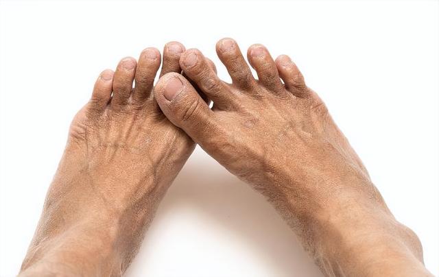 男性有没有衰老，“下半身”会说实话？假如都不占，恭喜还很年轻